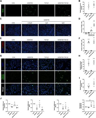 AZD6738 Inhibits fibrotic response of conjunctival fibroblasts by regulating checkpoint kinase 1/P53 and PI3K/AKT pathways